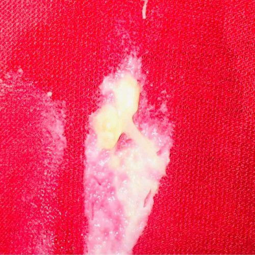 39weeks -MUCUS PLUG na ba to?