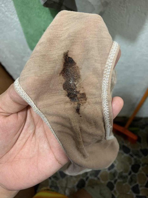 37weeks hello mga mommy ask ko lang po mucus plug na po ba ito hindi pa naman ako nakakaramdam
