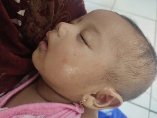 Solusinya bagaimana yaa