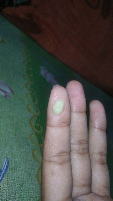 keputihan saat hamil muda