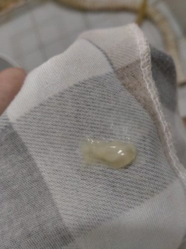 เเบบนี้ใช่มูกใสไหมคะ