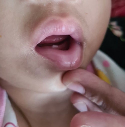 Gigi bayi 13 bulan