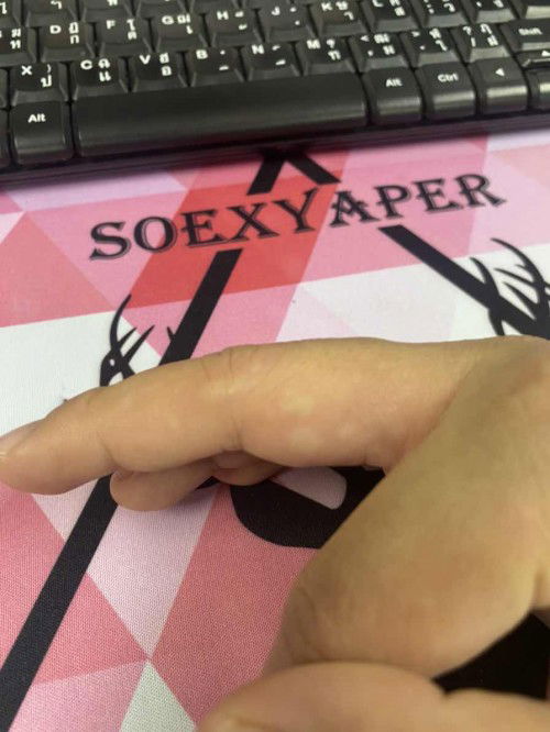 อายุครรภ์ 30w. คันมือ