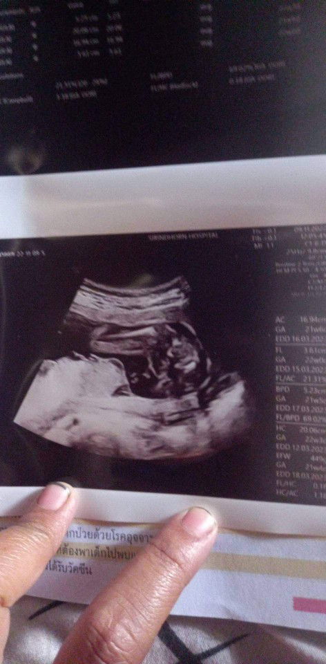 แม่ๆช่วยดูหน่อยค่ะว่าเพศหญิงหรือชาย