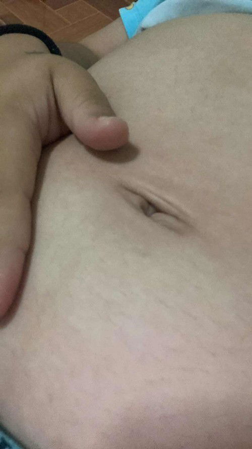 ลูกตอดเป็นแบบนี้รึป่าวค่ะ