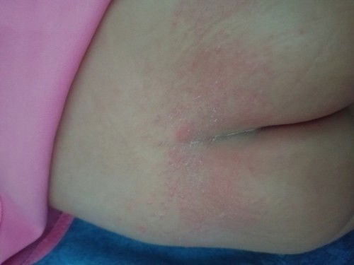 Mấy mom cho e bé vậy có phải bị hăm tã k ạ??