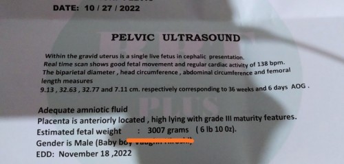 Ultrasound