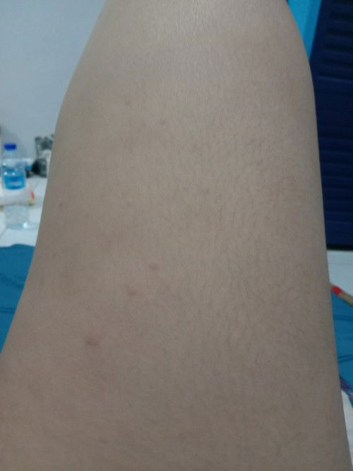 Obat/ salep gatel apa untuk bumil ?