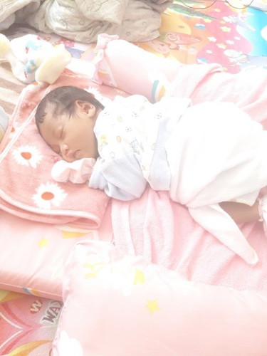 ภาวะตัวเหลือง