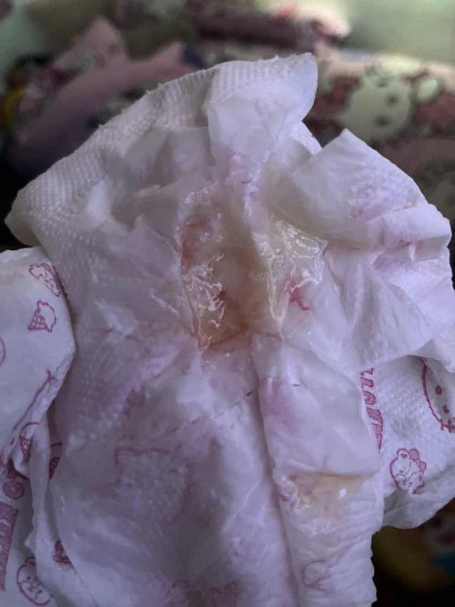 38+1 ท้องสอง   ท้องแรกคลอด39+6