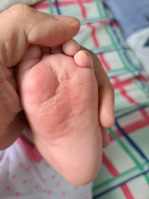 Namumulang paa ni Baby