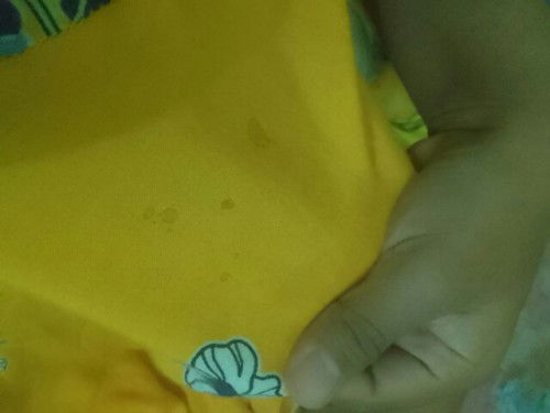 Air asi sudah keluar kehamilan 32w