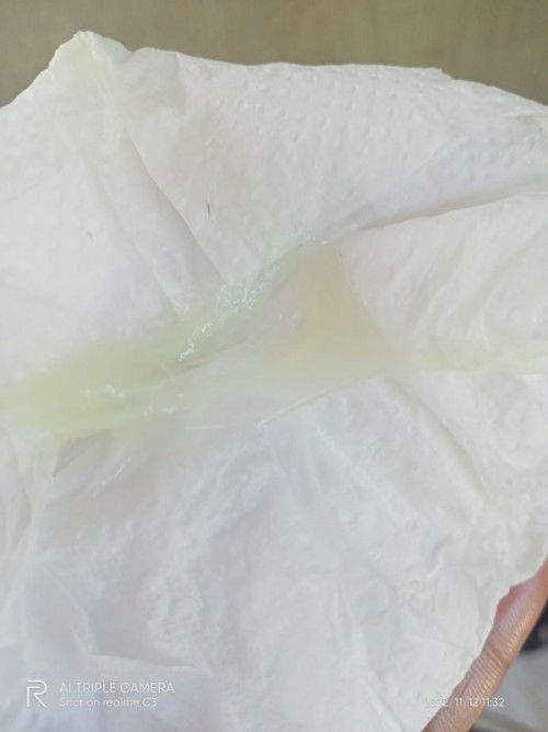 37w6d...possible sign of labor?