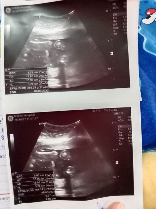 แม่ๆมองออกไหมค่ะ