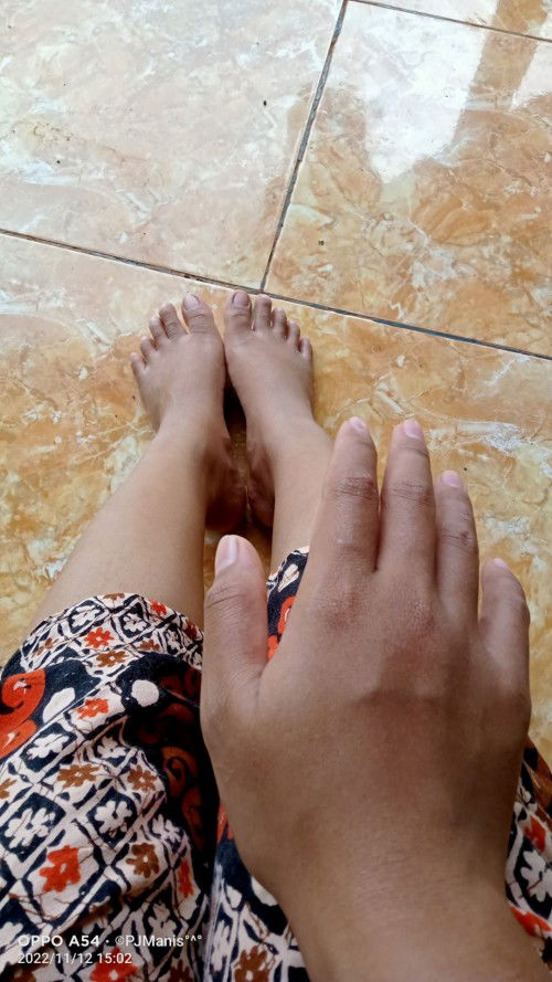 Kaki dan tangan bengkak