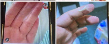 33 weeks pregnant normal ba ito