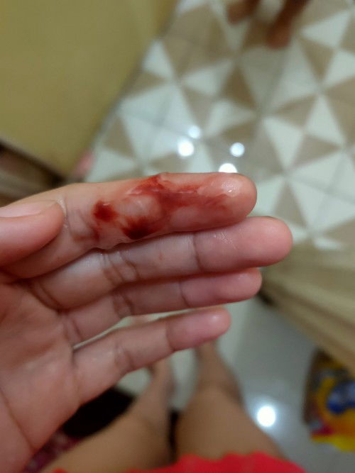 Keluar darah hamil 8 w