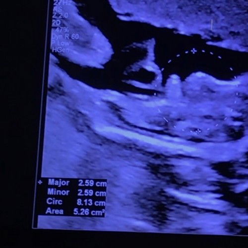 girl or boy po? 30weeks preggy 😊