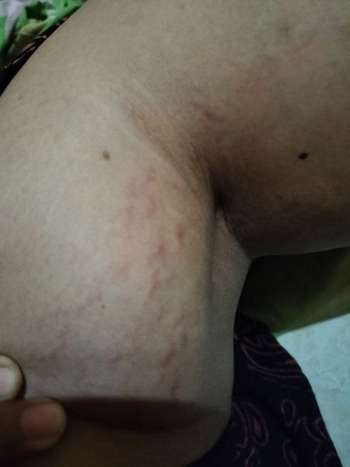 Ada yg kyak sy ngak bun tiba2 muncul garis merah bgni ?