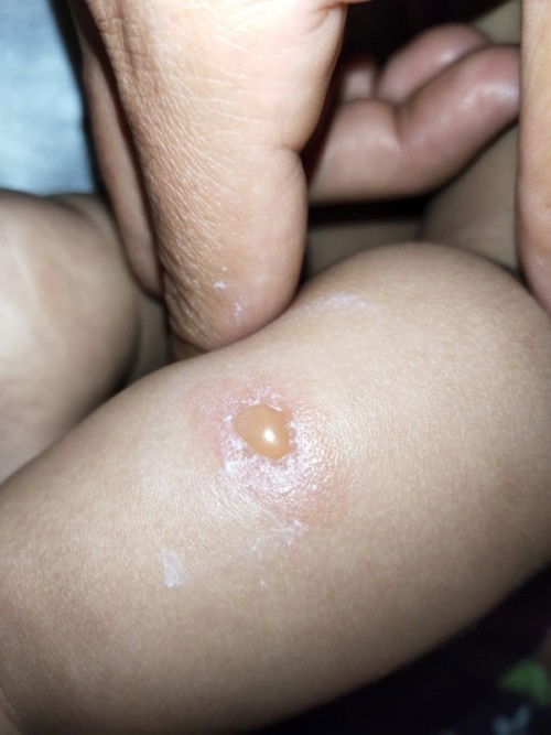 สอบถามแม่ๆค่ะ