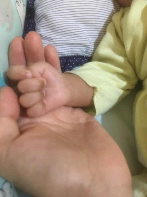 jempol bayi ngelipet terus