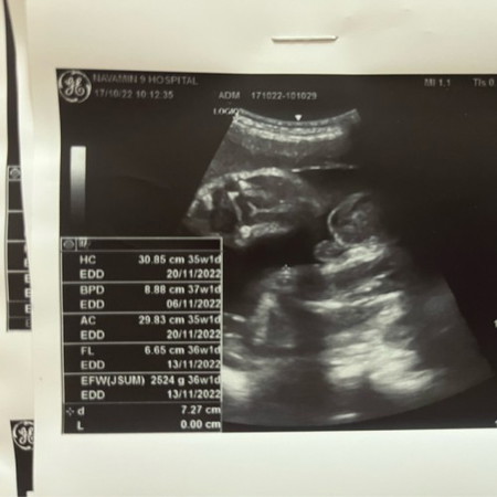 ขอสอบถามหน่อยจร้า