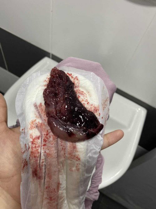 Keluar darah