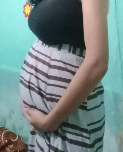 Hamil 20 Wk perut terlihat kecil