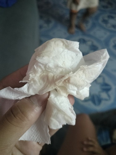มีน้ำแแบบนี้ออกค่ะ 39w6วันแร้วค่ะแม่ๆบ้านไหนเป็นบ้างค่ะ หมอนัดเร่งพรุ่งนี้แร้วค่ะ