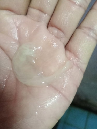 มีมูกออกแบบนี้คือใกล้คลอดหรือป่าวคะ