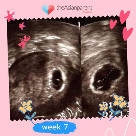 กังวลมากค่ะ ใครเจอคล้าย ๆ กัน ช่วยแชร์ให้เบาใจหน่อยนะคะ