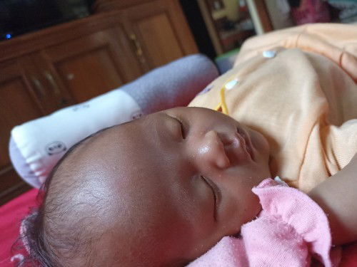 Bun rekomendasi cream buat ngilangin bintik putih diwajah bayi dong..