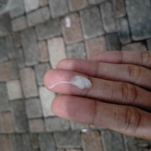 Keputihan in 36weeks