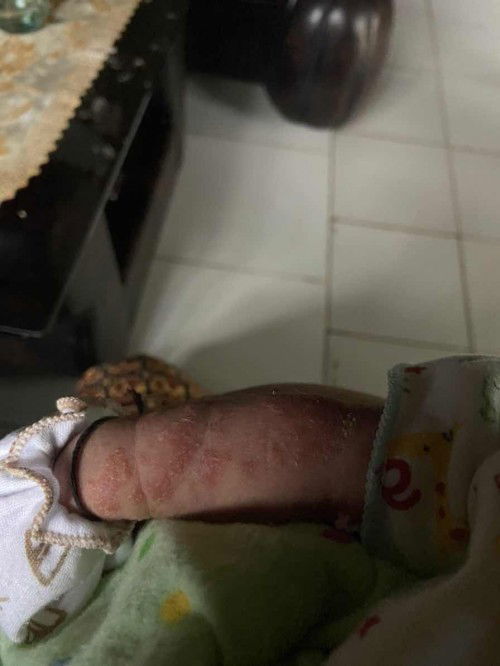 Kenapa ya bund bayi ku tangan nya begini kasian liat nya