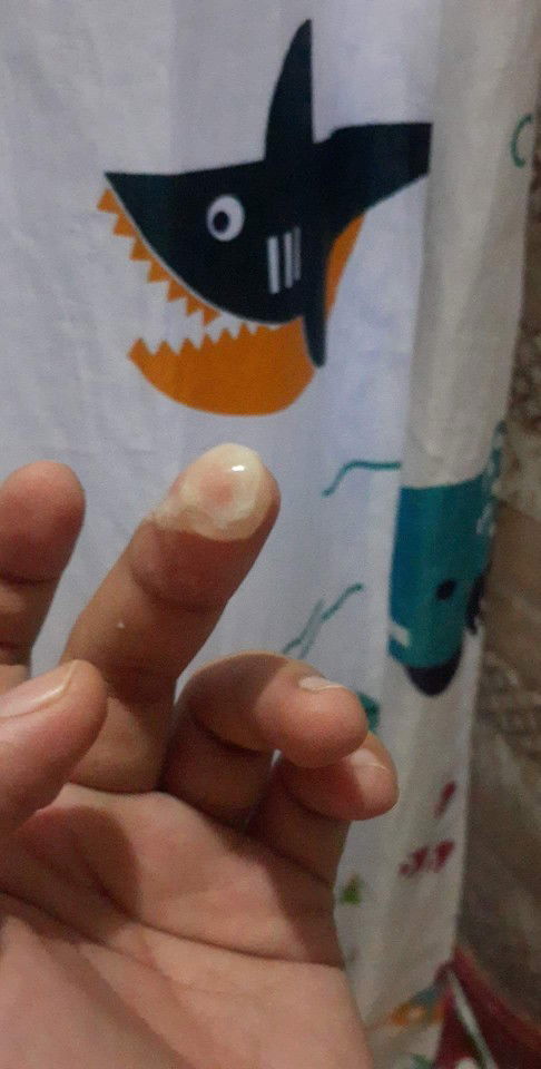 Hello po mga miii. Sana may mka sagot