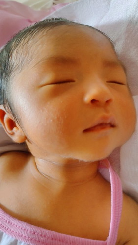 Hello mga mommies, normal lang po ba sa newborn baby na may tumurok na ganyan? sa mukha ni baby?