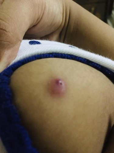 Keloyd? na nag sugat o naknak
2 months old palang si baby.