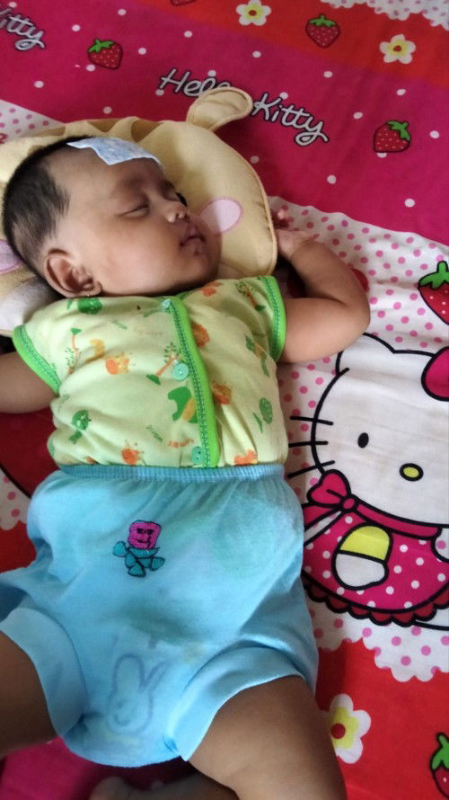 Bun itu Deket mata tanda lahir apa bukan yah . Klo iya kira2 bisa ilang gak yah..