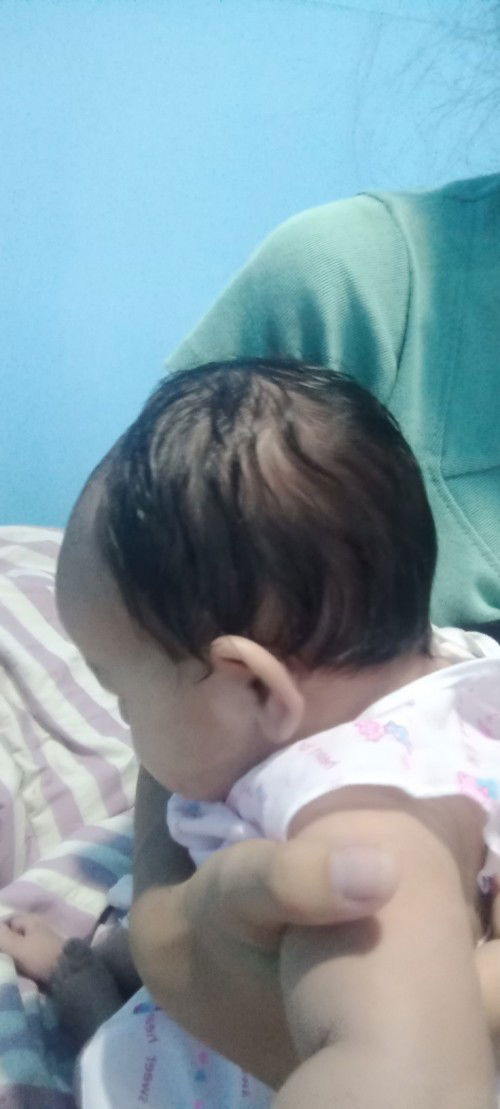 แบบนี้หัวแบนไหมคะแม่ๆ