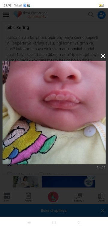 Bibir putih pecah pecah