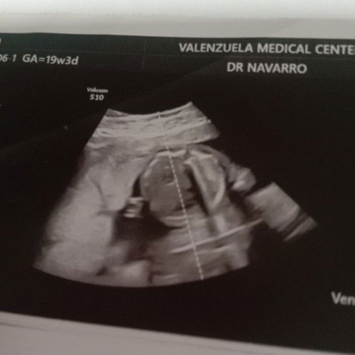 Anong pong masasabi nyo mga momshie girl ot boy sana po matulungan nio po ako salamat🙏💙