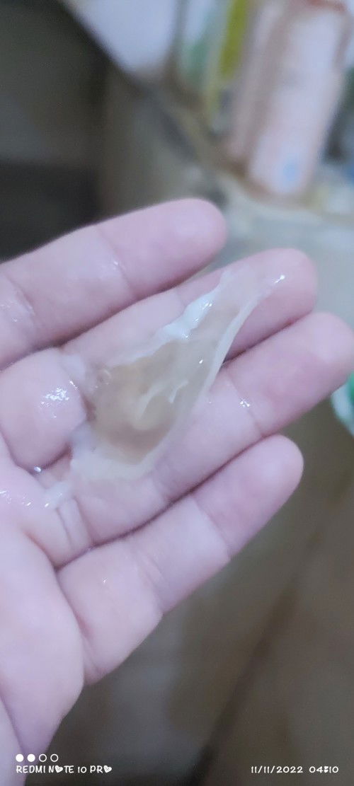 Keluar darah di usia 38w