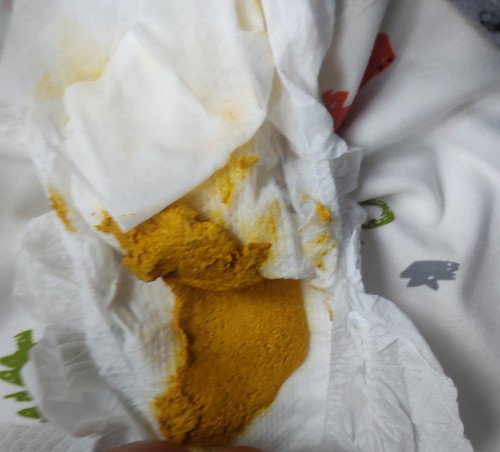 sorry po sa photo. hi mga mii. 
may nakatry na po bng ganito poops ni baby? normal padin po ba to?