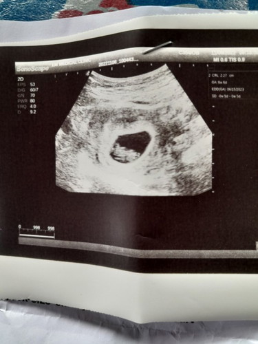 malalaman niyo po ba dito if girl or boy po kahit mga 2 months pa po tung ultrasound q? thanks...