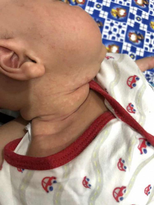 Kalau macam ni panau ke?