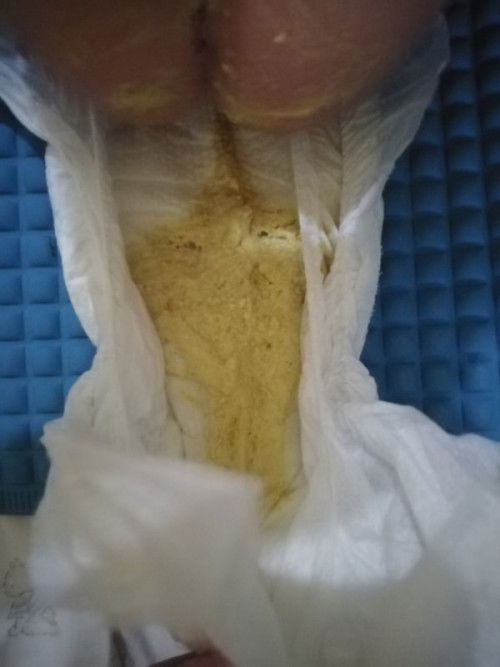 Kung normal tong poop ni lo