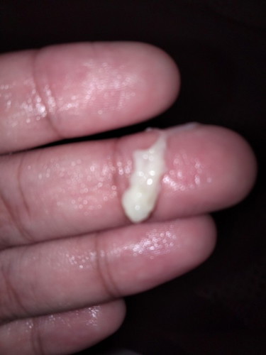 Normal discharge lang ba ito?