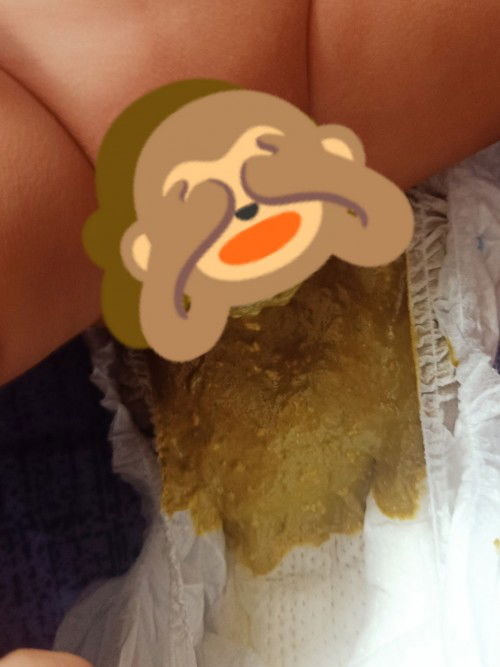 Hai mommies normal ke tak?