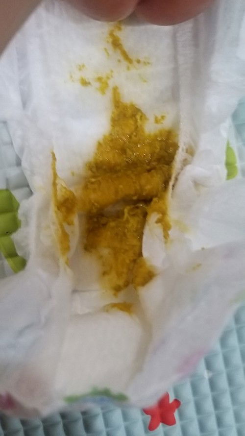 Bab cair usia satu bulan