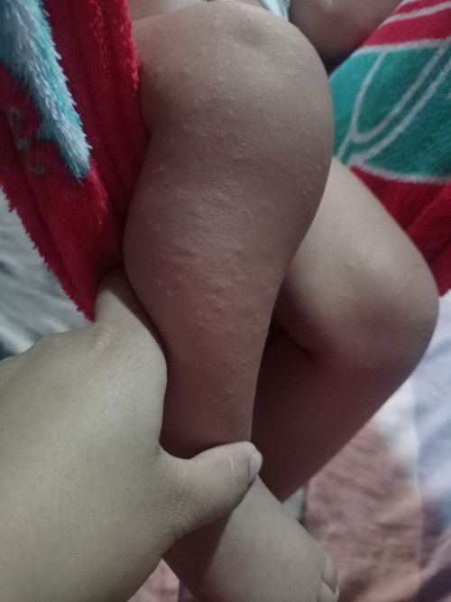 Mga Mii ano po kaya to sa skin Ng baby ko..
Wala nmn po syang lagnat..